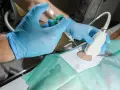 Lekarz pod kontrolą USG wykonuje iniekcję w okolicy stawu krzyżowo biodrowego.