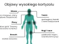 Objawy wysokiego kortyzolu: mgła mózgowa, lęki, bezsenność, "wdowi garb", otyłość brzuszna, okrągła twarz, osłabienie mięśni.