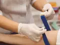 Pielęgniarka zakłada opaskę uciskową na ramię pacjenta przed pobraniem krwi. Badanie może wykazać podwyższony poziom mocznika.