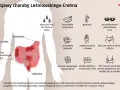 Objawy choroby Leśniowskiego-Crohna: ból brzucha, biegunka, zmęczenie, gorączka, problemy ze skórą i oczami.