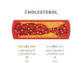 Przekrój naczynia krwionośnego z osadem cholesterolowym. Obok oznaczenia LDL (zły) i HDL (dobry) wskazują na normę cholesterolu całkowitego.