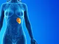 Anatomical illustration showing a translucent human torso with internal organs. The spleen, highlighted in orange, appears enlarged, indicating a potential medical condition.