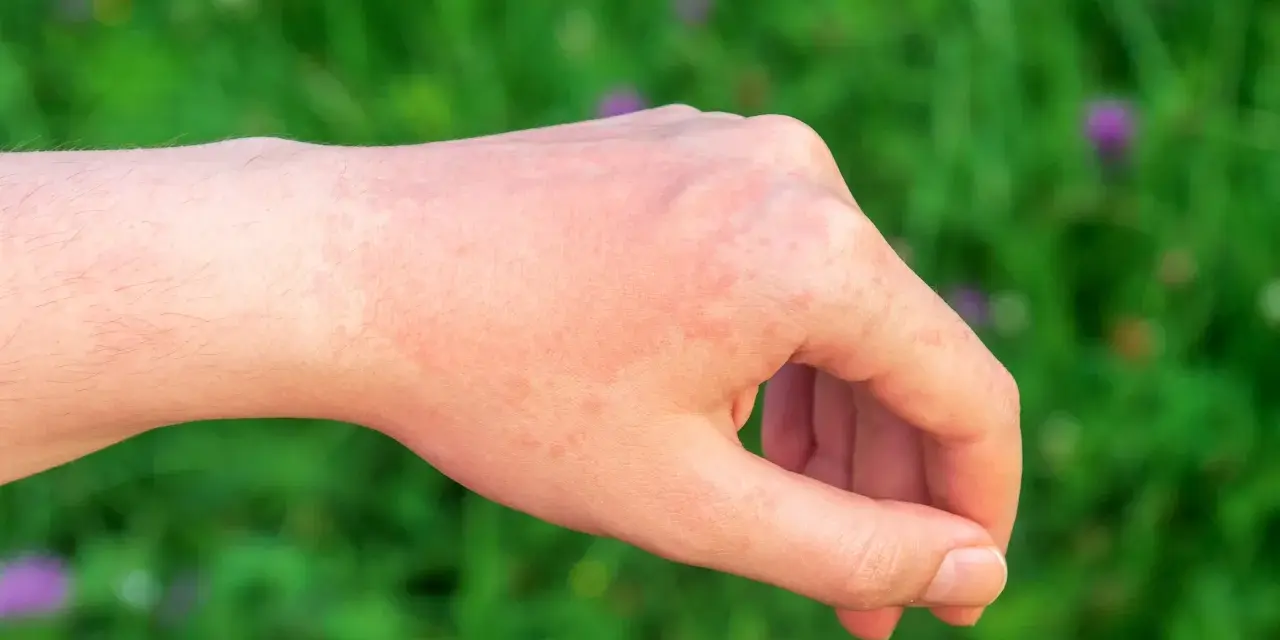 Alergia: Kiedy leki zaczynają działać? Szybka ulga i mity
