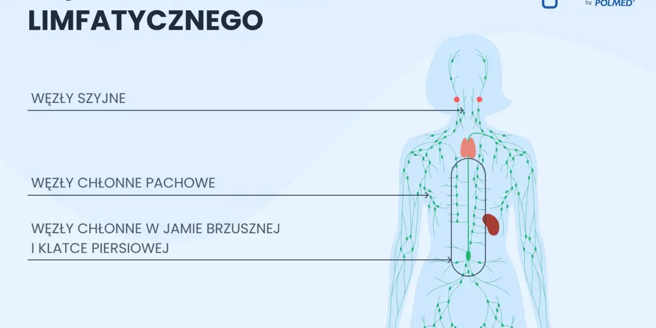 Schemat układu limfatycznego z zaznaczonymi węzłami chłonnymi szyjnymi, pachowymi, w jamie brzusznej i klatce piersiowej, a także węzłami chłonnymi pachwinowymi.