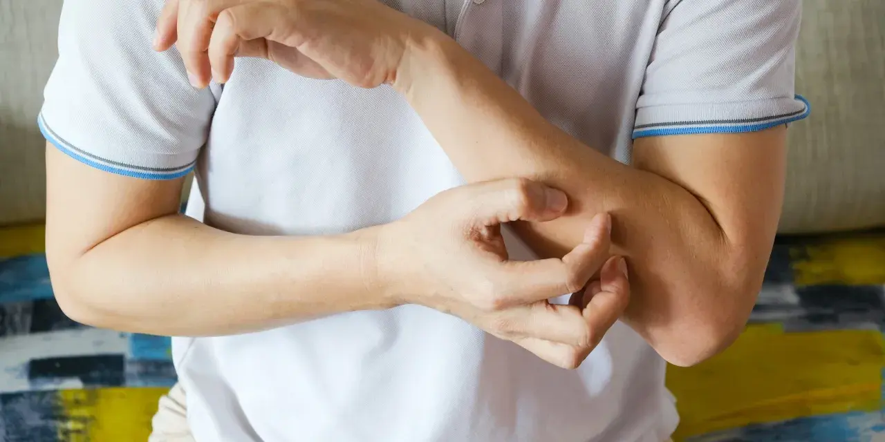 Dłoń drapiąca przedramię, być może jeden z objawów HIV.