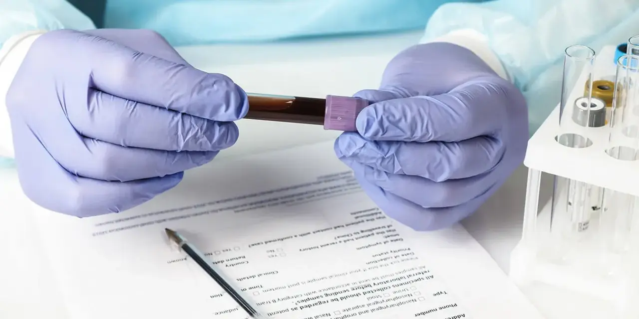 Ręce w rękawiczkach trzymają probówkę z krwią. Wyniki badań wskazują na eozynofile niskie, co może wymagać dalszej diagnostyki.