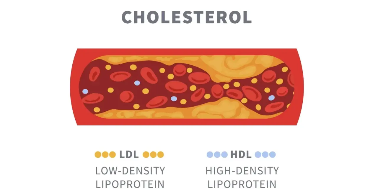 Przekrój naczynia krwionośnego z osadem cholesterolowym. Obok oznaczenia LDL (zły) i HDL (dobry) wskazują na normę cholesterolu całkowitego.
