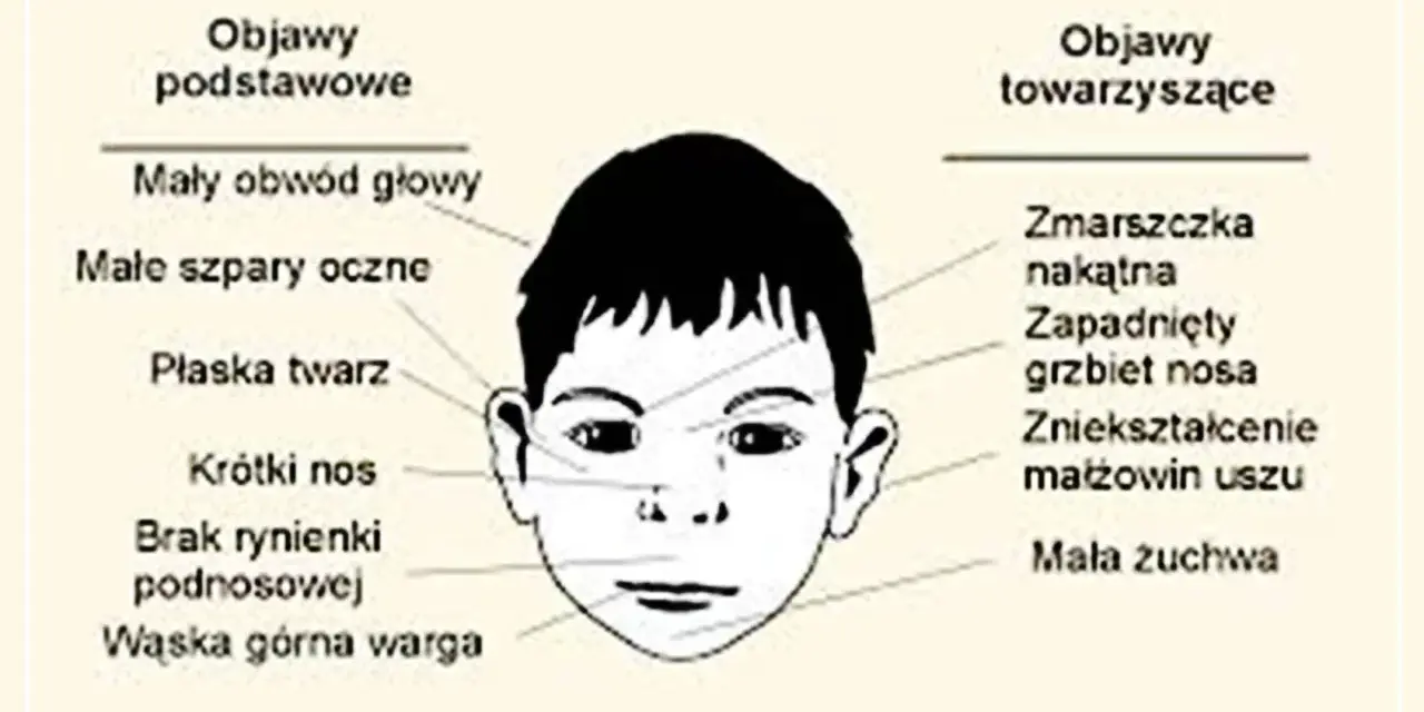 Objawy FAS: Jak je rozpoznać i skutecznie pomóc dziecku?
