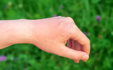 Alergia: Kiedy leki zaczynają działać? Szybka ulga i mity