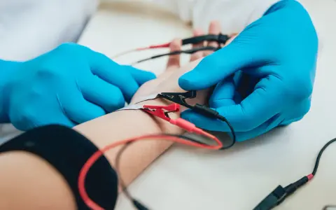 Lekarz w niebieskich rękawiczkach podłącza elektrody do ręki pacjenta. To badanie EMG, które pozwala ocenić funkcje nerwów i mięśni.