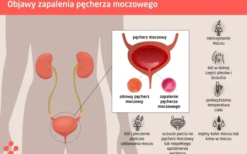 Pieczenie przy sikaniu? Jakie leki na zapalenie cewki moczowej?