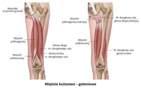 Anatomia mięśni uda: mięsień półścięgnisty i półbłoniasty, głowy mięśnia dwugłowego uda.