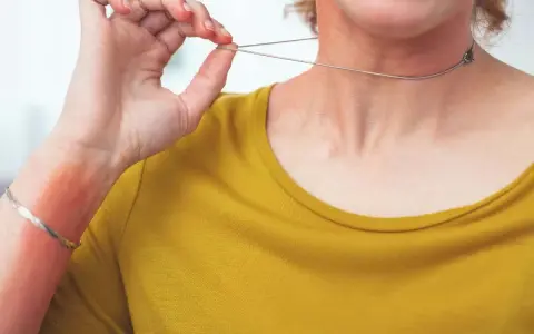 Alergia na srebro? Nikiel to problem! Wybierz bezpieczną biżuterię