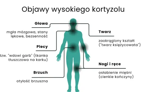 Objawy wysokiego kortyzolu: mgła mózgowa, lęki, bezsenność, "wdowi garb", otyłość brzuszna, okrągła twarz, osłabienie mięśni.