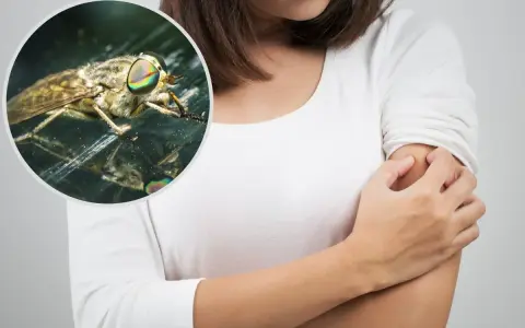 Kobieta drapie ramię po ugryzieniu muchy końskiej. Widok z bliska na owada z tęczowymi oczami.