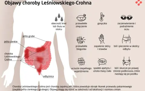 Objawy choroby Leśniowskiego-Crohna: ból brzucha, biegunka, zmęczenie, gorączka, problemy ze skórą i oczami.