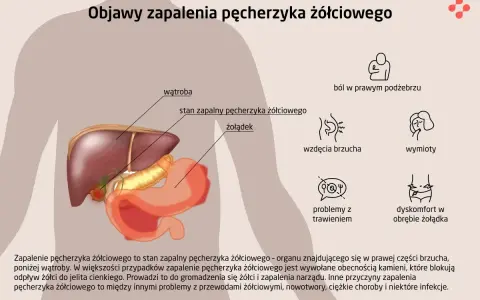 Ilustracja przedstawia anatomię jamy brzusznej z zaznaczonym pęcherzykiem żółciowym, wątrobą i żołądkiem. Opisuje objawy zapalenia pęcherzyka żółciowego.