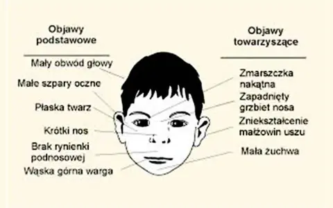 Objawy FAS: Jak je rozpoznać i skutecznie pomóc dziecku?