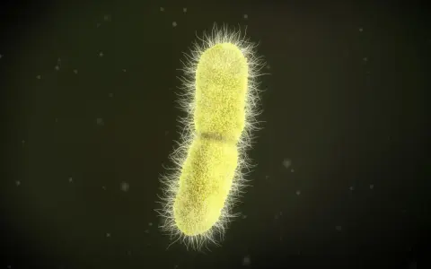 Żółta bakteria z licznymi rzęskami, przypominająca kształtem pałeczkę, to Klebsiella pneumoniae.