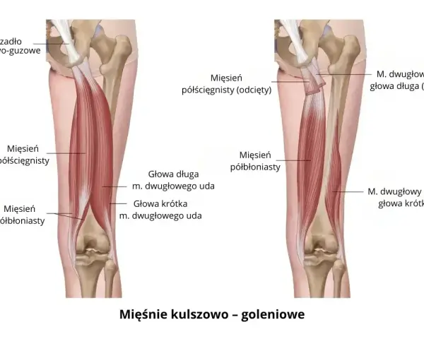 Anatomia mięśni uda: mięsień półścięgnisty i półbłoniasty, głowy mięśnia dwugłowego uda.