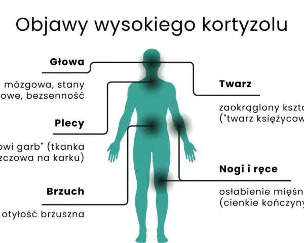 Objawy wysokiego kortyzolu: mgła mózgowa, lęki, bezsenność, "wdowi garb", otyłość brzuszna, okrągła twarz, osłabienie mięśni.