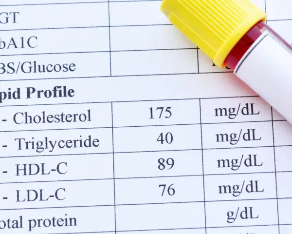 Wynik lipidogramu: cholesterol 175 mg/dL, triglicerydy 40 mg/dL, HDL-C 89 mg/dL, LDL-C 76 mg/dL. Wynik wskazuje na wysoki cholesterol.