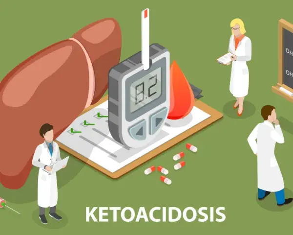 Lekarze analizują wyniki badań, glukometr wskazuje wysoki poziom cukru, a na tablicy wzór chemiczny. To obrazuje problem kwasicy ketonowej.