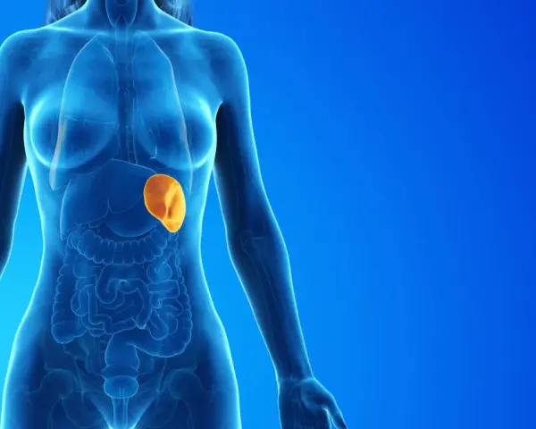 Anatomical illustration showing a translucent human torso with internal organs. The spleen, highlighted in orange, appears enlarged, indicating a potential medical condition.