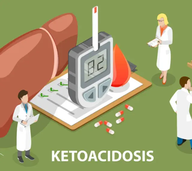Lekarze analizują wyniki badań, glukometr wskazuje wysoki poziom cukru, a na tablicy wzór chemiczny. To obrazuje problem kwasicy ketonowej.