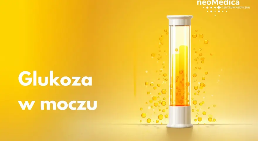 Biały napis "Glukoza w moczu" na żółtym tle. Obok probówka z żółtym płynem i pęcherzykami.