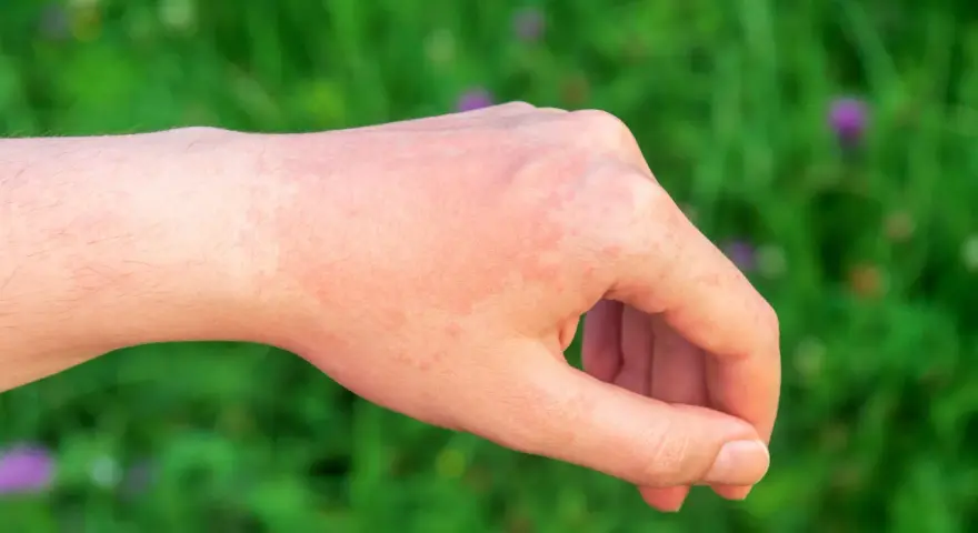 Alergia: Kiedy leki zaczynają działać? Szybka ulga i mity
