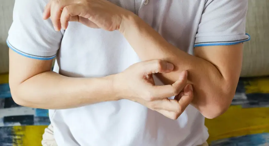 Dłoń drapiąca przedramię, być może jeden z objawów HIV.