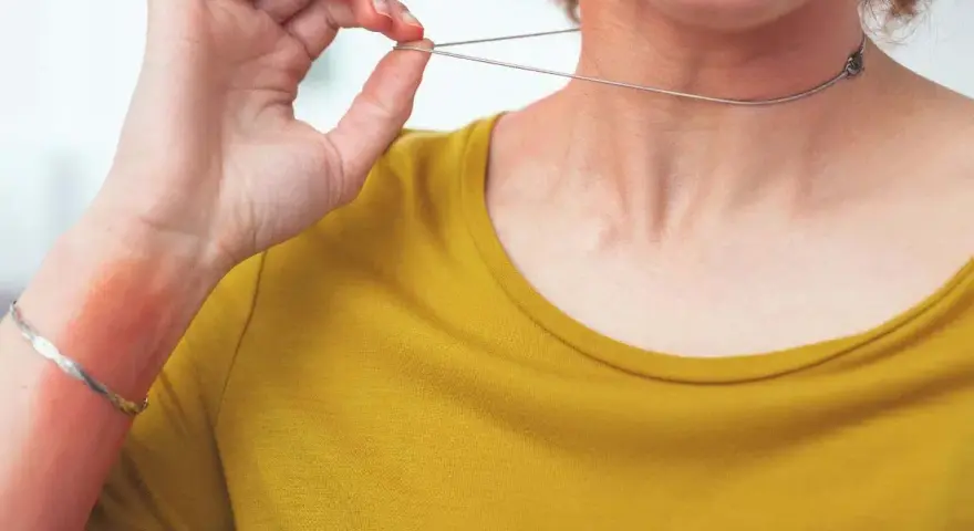 Alergia na srebro? Nikiel to problem! Wybierz bezpieczną biżuterię