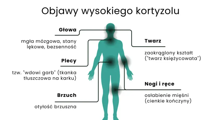 Objawy wysokiego kortyzolu: mgła mózgowa, lęki, bezsenność, "wdowi garb", otyłość brzuszna, okrągła twarz, osłabienie mięśni.