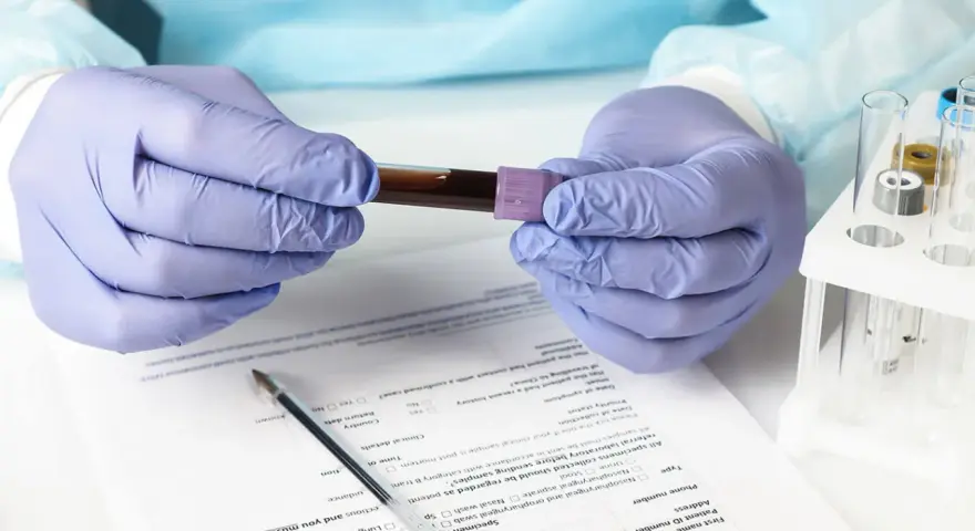 Ręce w rękawiczkach trzymają probówkę z krwią. Wyniki badań wskazują na eozynofile niskie, co może wymagać dalszej diagnostyki.