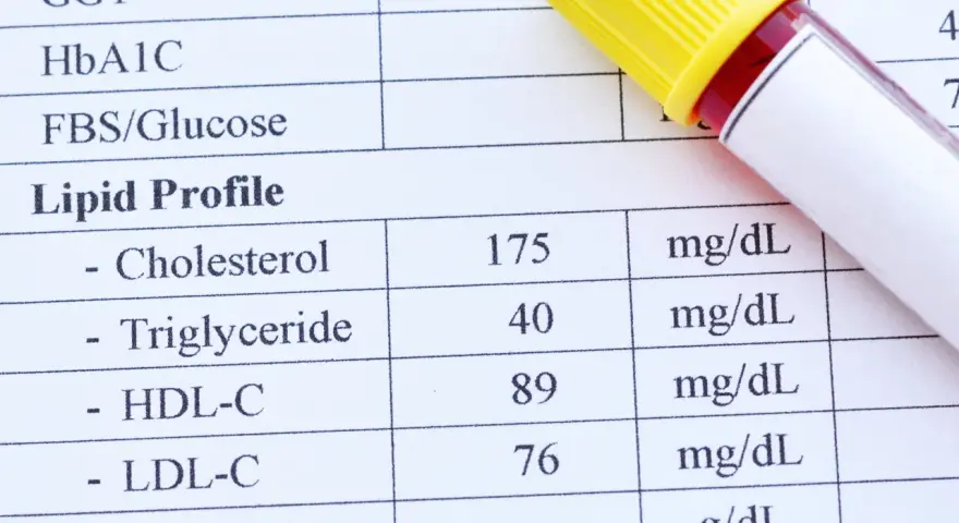 Wynik lipidogramu: cholesterol 175 mg/dL, triglicerydy 40 mg/dL, HDL-C 89 mg/dL, LDL-C 76 mg/dL. Wynik wskazuje na wysoki cholesterol.