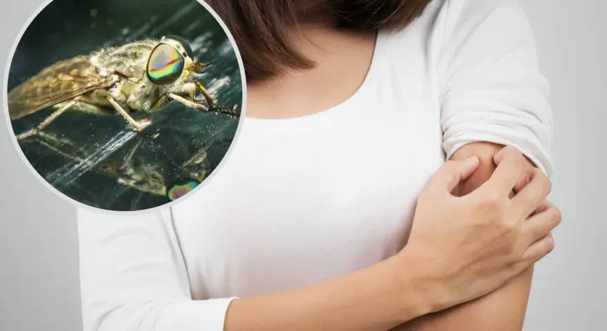 Kobieta drapie ramię po ugryzieniu muchy końskiej. Widok z bliska na owada z tęczowymi oczami.