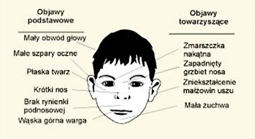 Objawy FAS: Jak je rozpoznać i skutecznie pomóc dziecku?