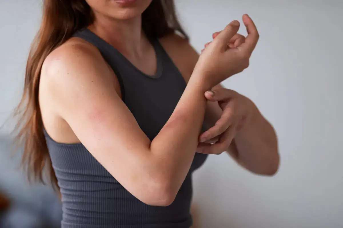 Alergia na roztocza kurzu domowego objawy