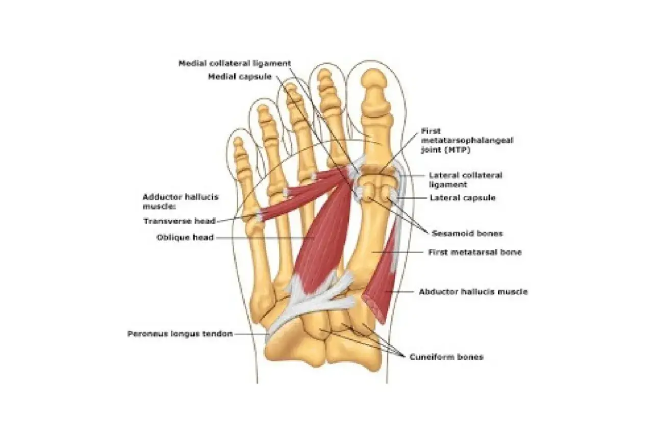 Anatomia stopy z zaznaczonymi mięśniami, więzadłami i kośćmi. Widoczny mięsień przywodziciel palucha (adductor hallucis), który może być przyczyną haluksów.