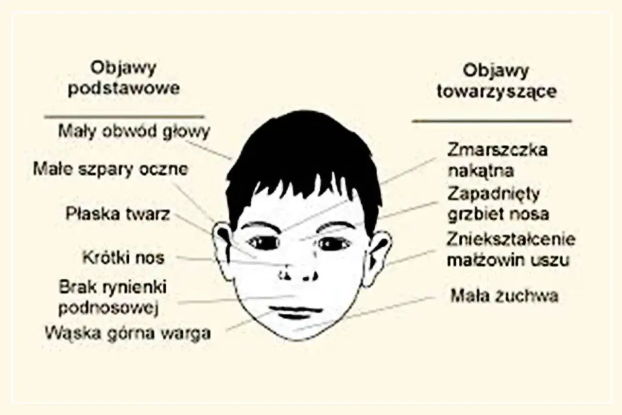 dziecko z FAS i rodzic