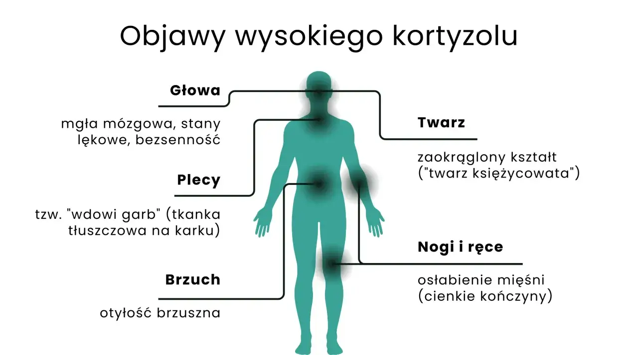 Objawy wysokiego kortyzolu: mgła mózgowa, lęki, bezsenność, garb, otyłość brzuszna, okrągła twarz, osłabienie mięśni.