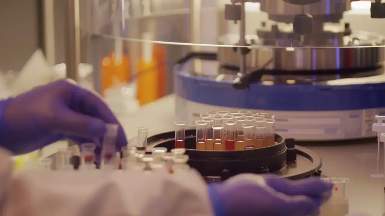 Rękawiczki laboratoryjne obsługują probówki z próbkami krwi, gdzie analizowane są eozynofile niskie.