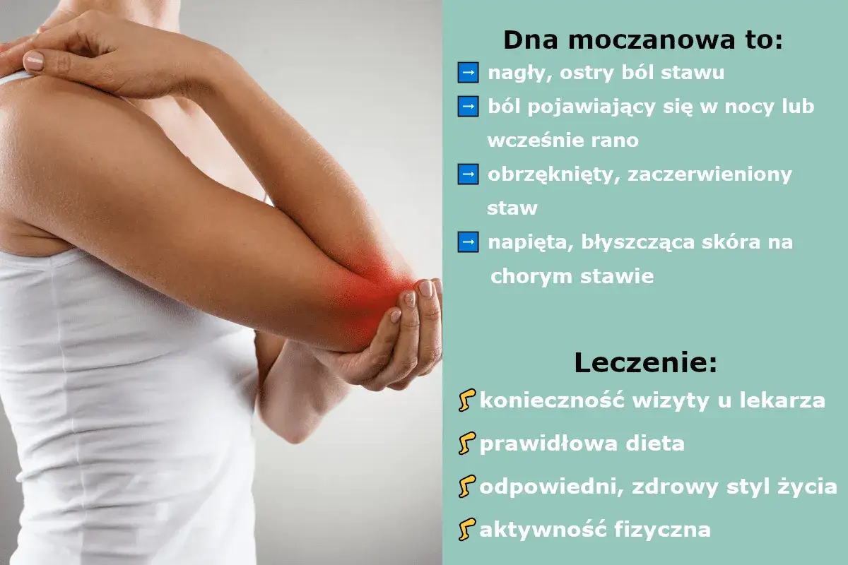 Leki NLPZ bez recepty na dnę moczanową