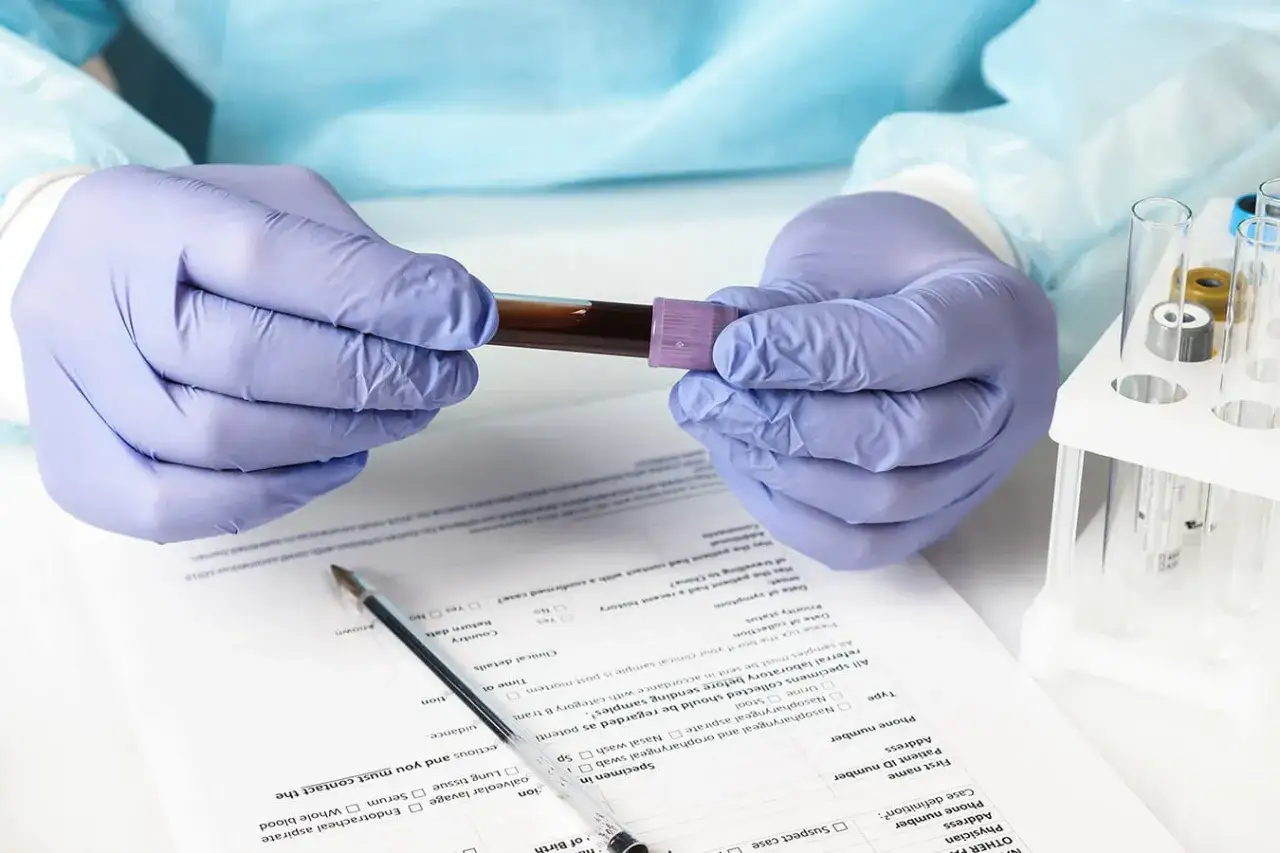 Ręce w rękawiczkach trzymają probówkę z krwią, obok formularz medyczny i stojak z próbówkami. Wyniki badań wskazują na eozynofile niskie.