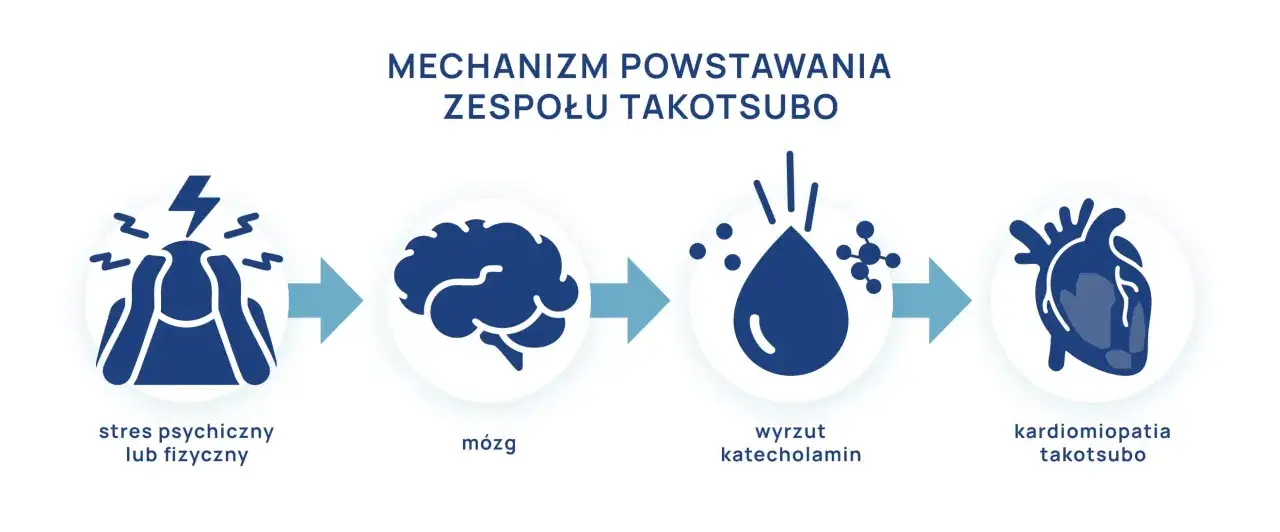 Syndrom złamanego serca a zawał serca r&oacute;żnice